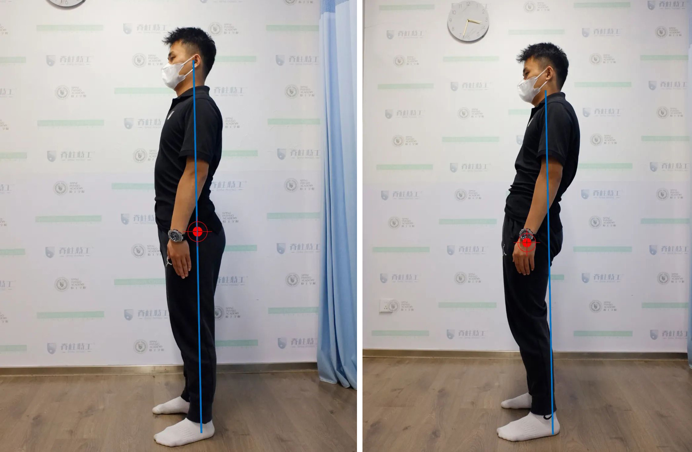 骨盆前倾|骨盆体位你分得清吗？别瞎练了，你根本不是骨盆前倾！