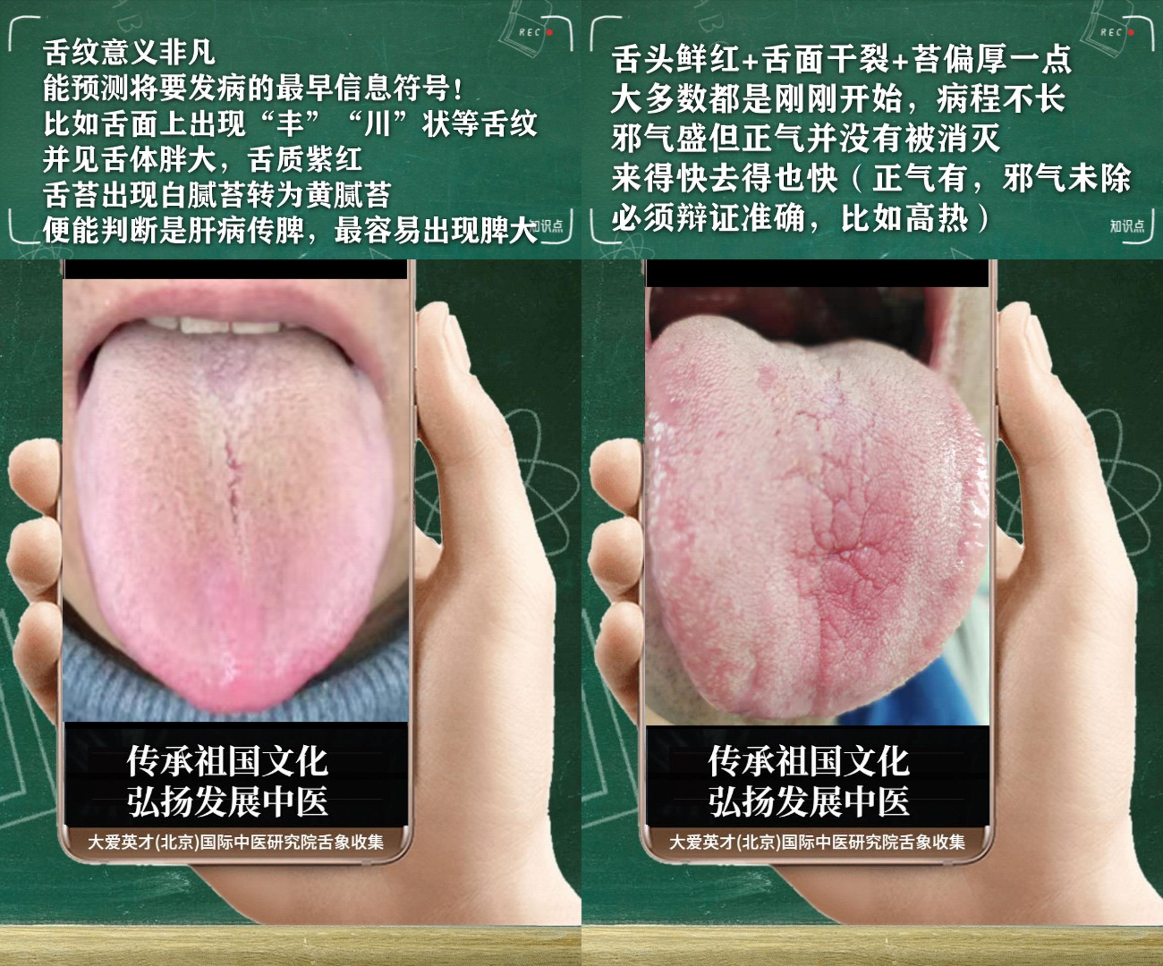 内分泌失调|中医实例:面色黄暗,内分泌失调,鼻子不通,肝气郁滞