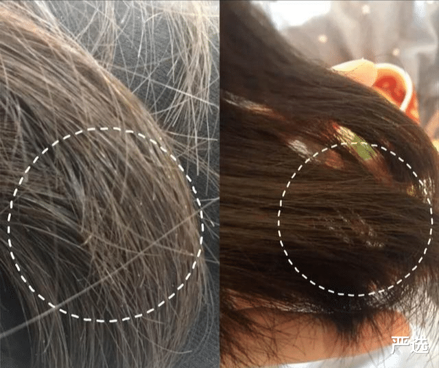 洗发水|三种早已进入“黑名单”的洗发水,价钱贵还掉发,很多人都用过