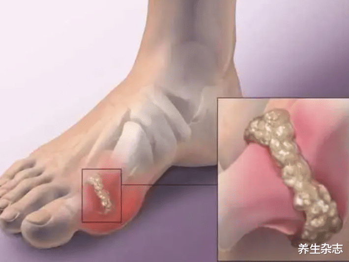 |“热汤变毒汤”，多名院士联合呼吁：喝一口等于钢丝球“刮肾”，趁早忌口