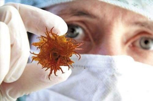 感冒|医学新知：癌症自愈或有4个“途径”，记住一个或能挽救生命！