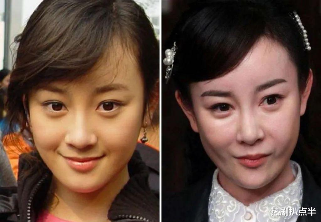 刘涛|别乱动脸、瞎养生了！这些靠运动保持状态的女星，才是真聪明