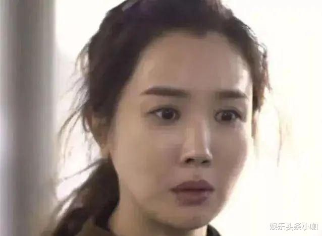 蛇精脸|整成蛇精脸，这是退圈不演戏了？