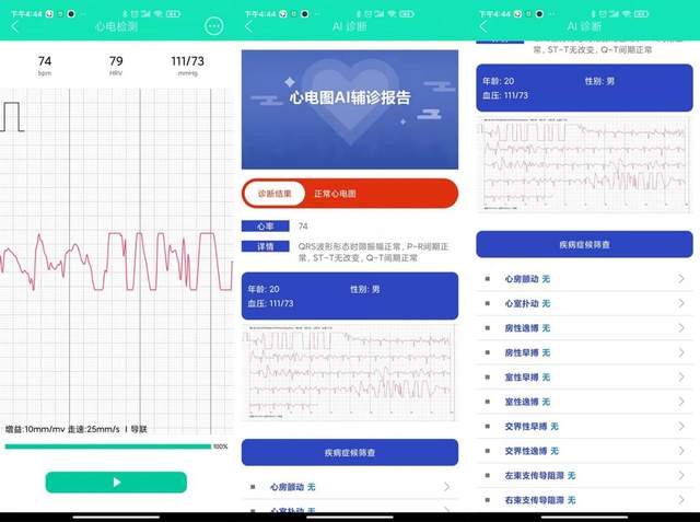 智能手表|随身陪伴的健康管家，dido E10血压心电智能手表体验