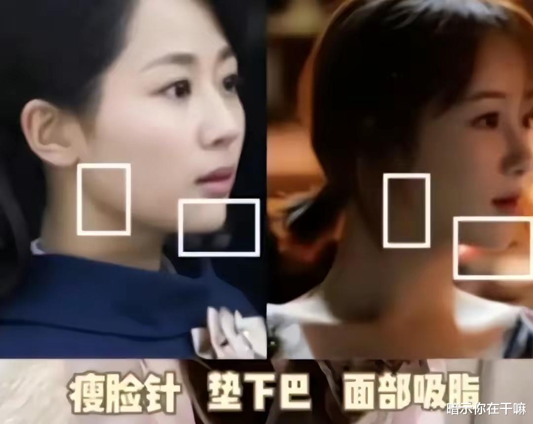 整容|明明吃了“整容”带来的红利，她们却死不承认？