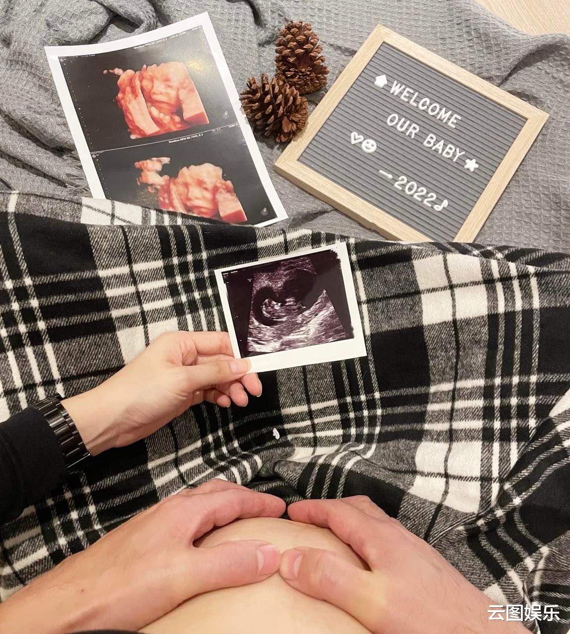 陈熙锋|恭喜！双胞胎男星宣布小11岁妻子产女，陪进产房亲手剪脐带太感动