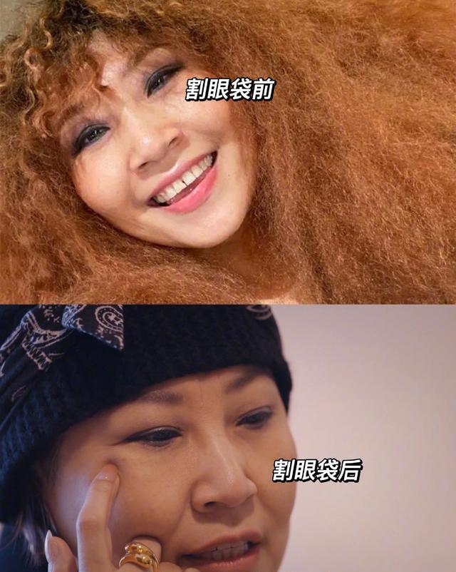 张蔷|女星张蔷整容失败责怪医生，向网友展示眼角疤痕，直言有容貌焦虑