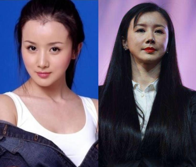 白梦妍|看到整容失败的明星，你还会去整容吗