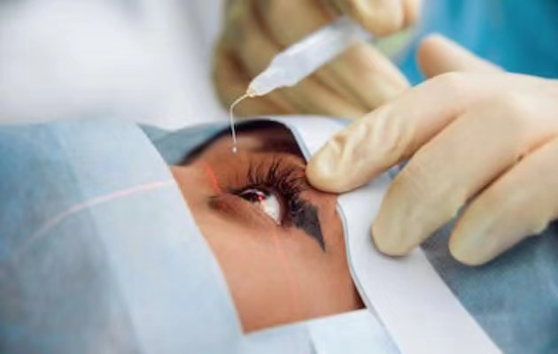 结直肠癌|什么才是视力最大的杀手?