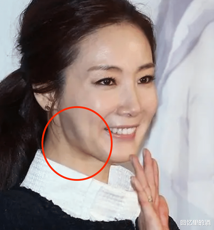 整容|韩国娱乐圈很现实，整容脸僵的演员立马被淘汰，原装脸事业长青