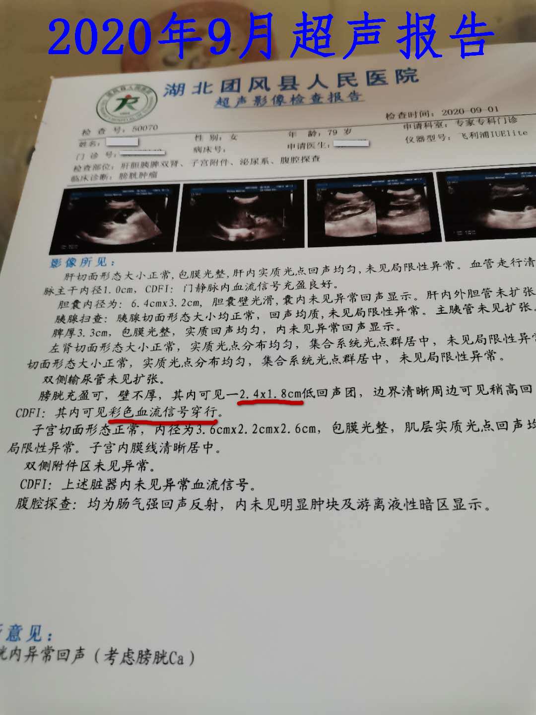 猪肉|膀胱肿瘤不手术,只吃中药行不行?