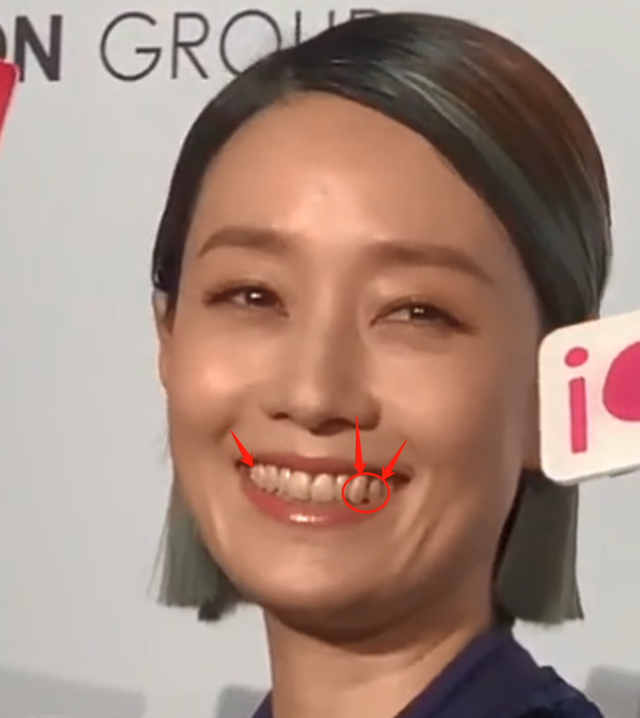 马伊琍|45岁马伊俐生图曝光，一口黄牙污垢明显，网友：好恶心