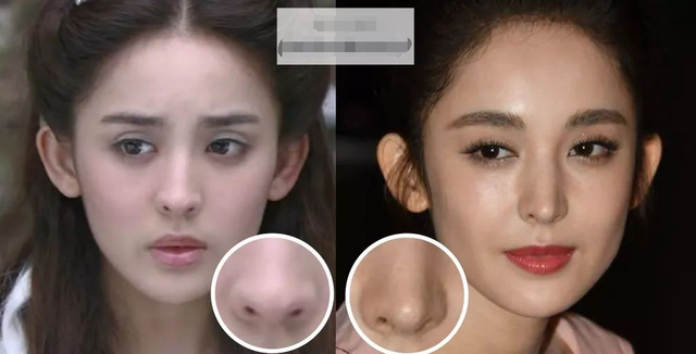 明星|这些明星们的假鼻子，绝了！都是狠人