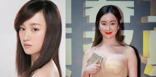 白梦妍|看到整容失败的明星，你还会去整容吗