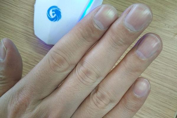 睡眠|为什么会经常手麻,怎么做能改善?谨记这2点,或能帮到你