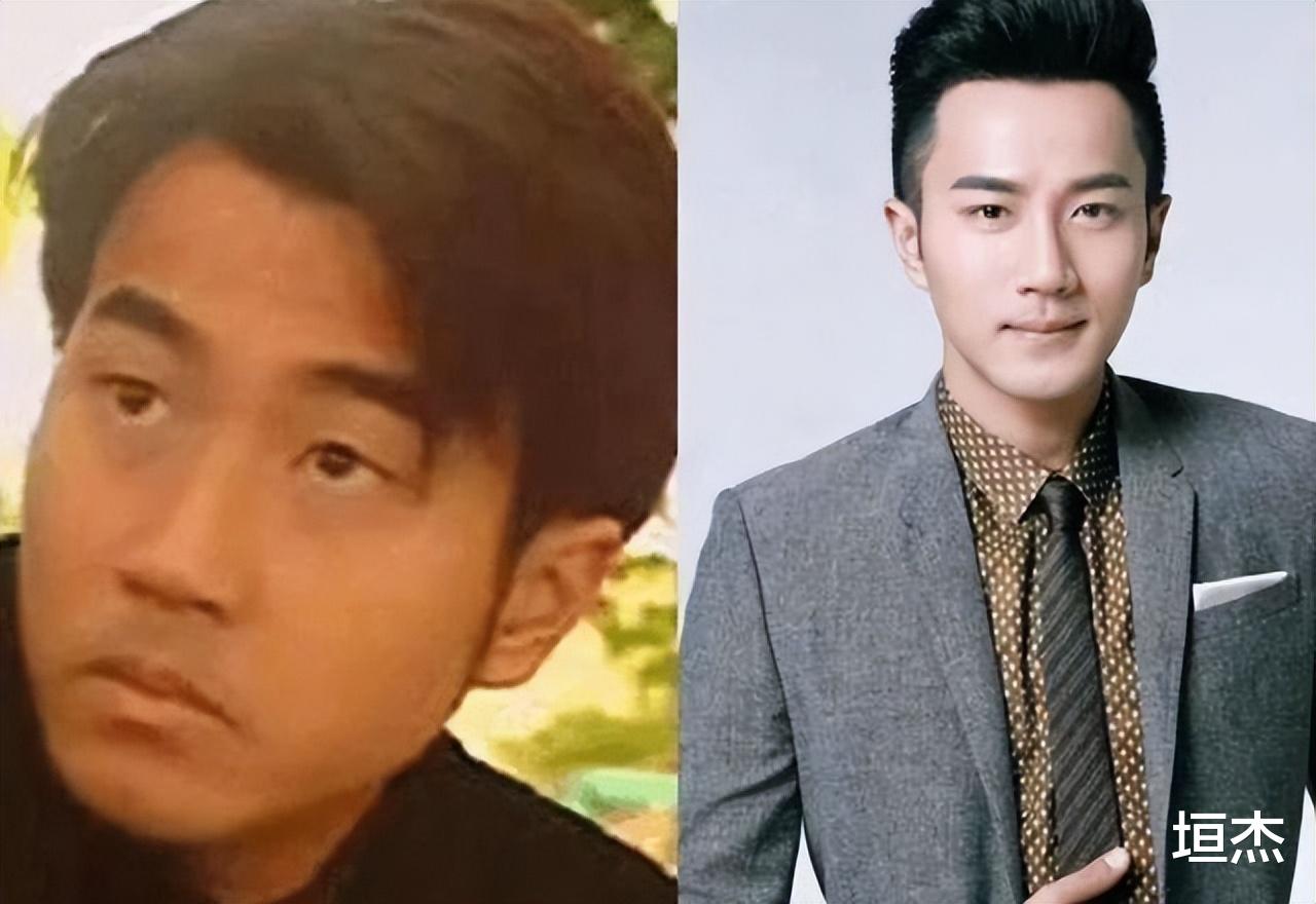 明星|割了双眼皮就判若两人，这10位明星动脸太成功了