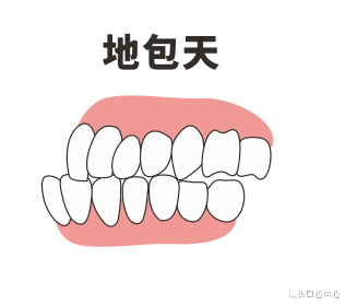 牙齿|年龄越小戴牙套效果越好？不，是颌面管理越早越好