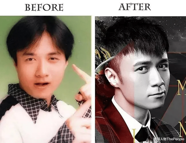 陈晓东|香港男神也整容？46岁陈晓东变“悲伤蛙”，林峰医美过程被曝光