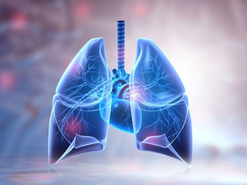 哮喘|哮喘新药：缓解发作症状并降低恶化，固定剂量组合Airsupa获批
