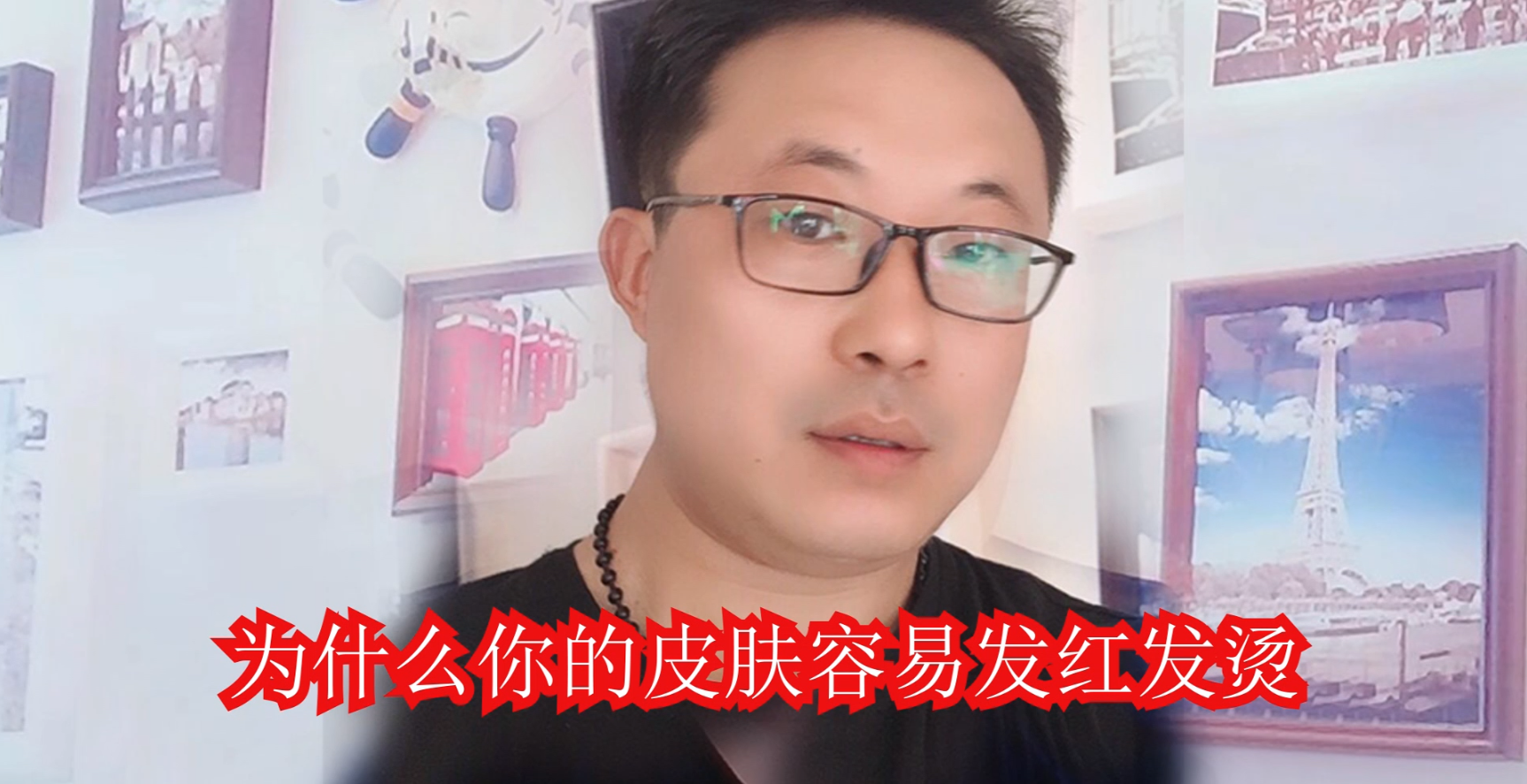 35-1，为什么你的皮肤容易发红发烫