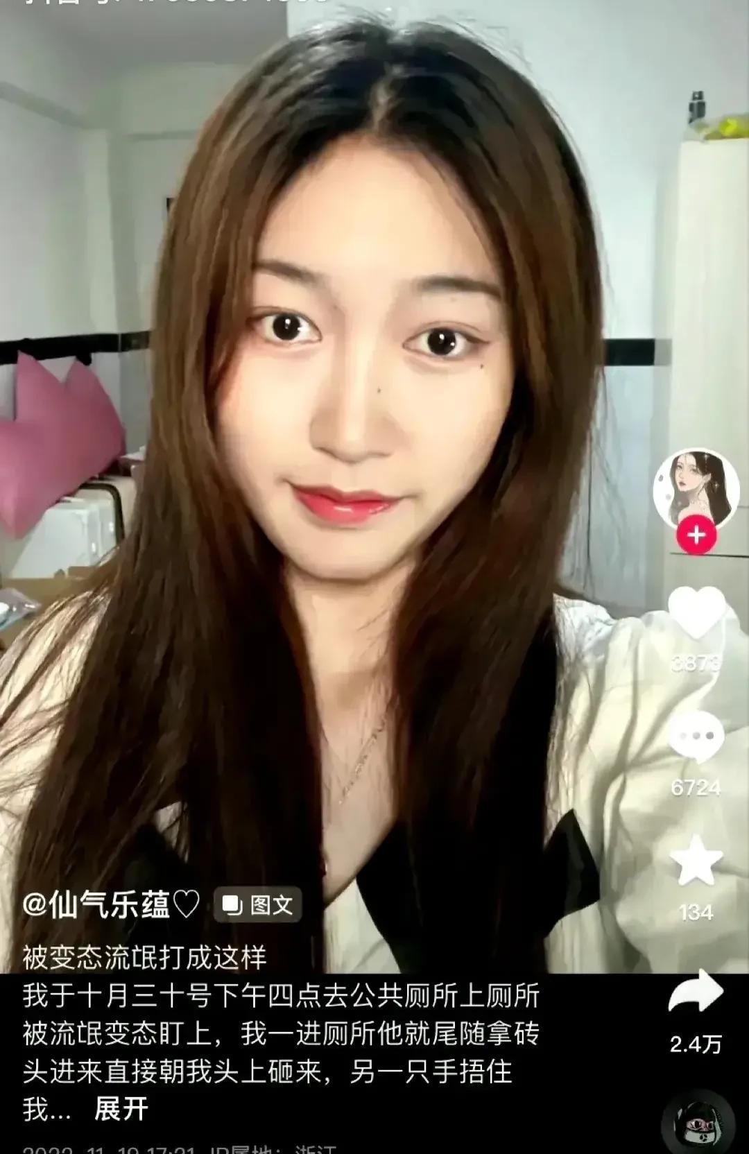 今日,公厕被打女子发声:不认识他,万幸眼球保住了,清白保住了