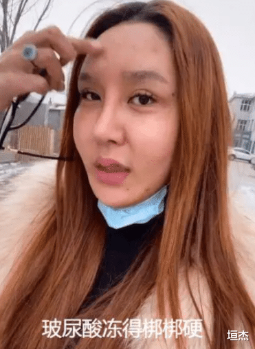 整容|网红金大威：哭诉整容失败史，小鲜肉变沧桑大叔，到底是谁害了他