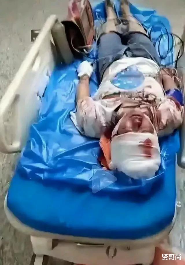 ?唐山打人事件拨动了大众的神经?凶残程度绝不输孙小果