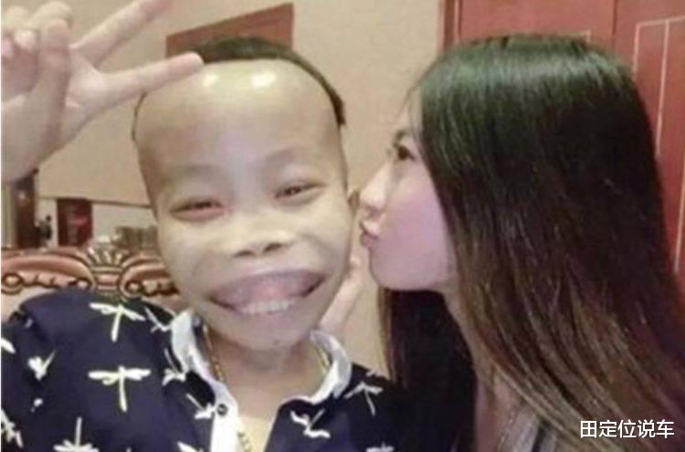 陈山|曾逆袭人生的“丑男”陈山，豪车美女不缺，被封现状唏嘘不已