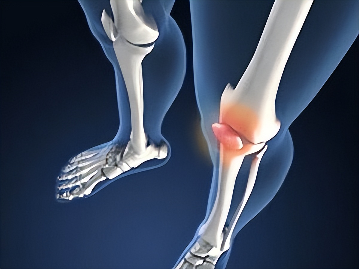 冰糖|送你一个中成药,把你藏在骨缝、关节里的风、湿、寒给吸出来