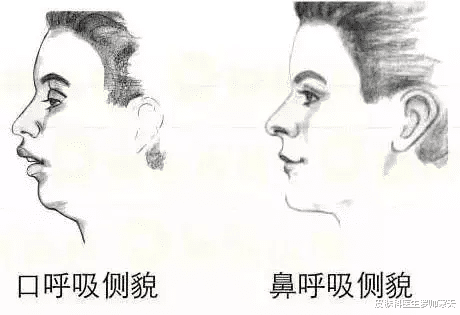 睡眠 睡美容觉？这样睡不仅不会变美，反而又胖又老！万万没想到…