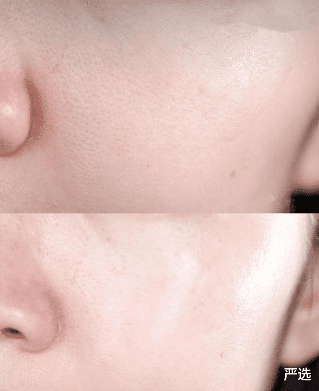 翁虹|50岁翁虹与44岁林志颖同框，颜值太抗打！网友：这是“成精”了吗？