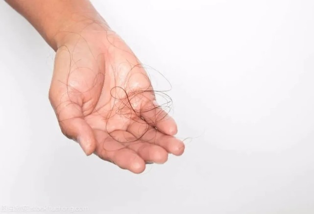 白术|坚持用“硫磺皂”洗头会怎样?或许能改善4大头皮问题,早做了解