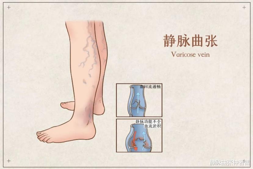 国家卫健委|困在蚯蚓腿里的90后们，快来看看是怎么回事？