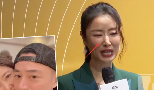 林心如|林心如鼻子怪异被质疑整容，本人发声否认：从出生以来就长这样