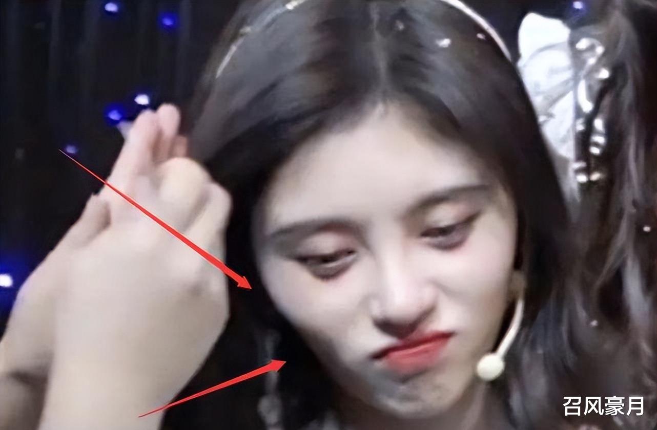 整容|整容成瘾，瘦到病态，痴迷于少女人设，内娱可怕的畸形审美