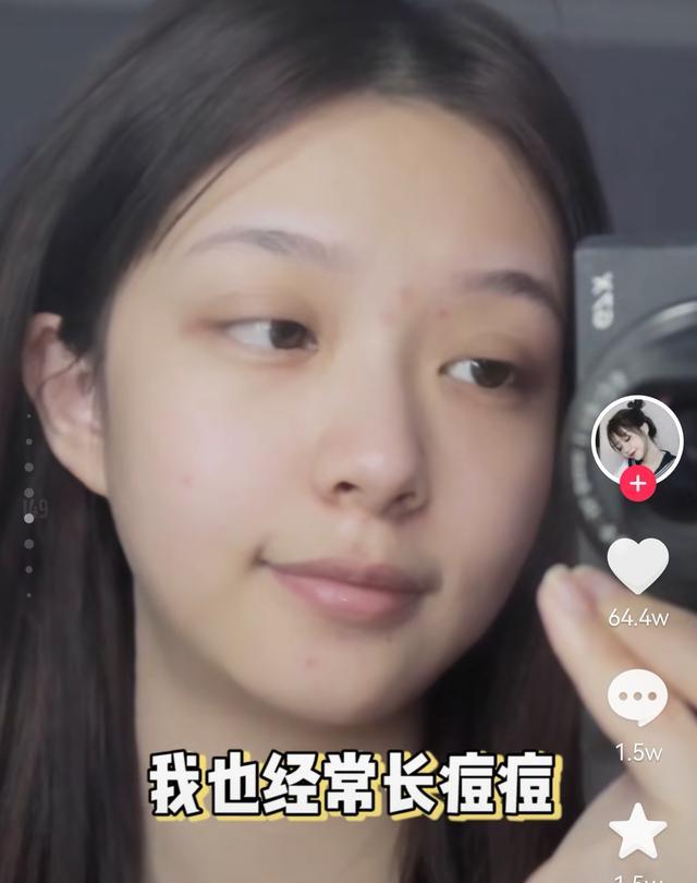 明星素颜|杨超越晒素颜照,戴美瞳脸上起痘痘,底下评论吵翻天