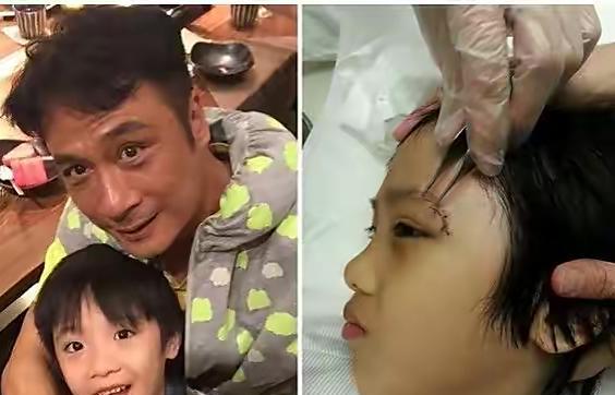 文咏珊|任鲁豫摔伤细节曝光，背部着地疑似伤到脊椎，本人回应令人担心