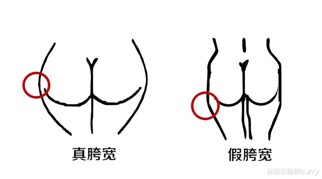 老年病|有一种\臀腿肥大\叫\假胯宽\，4个动作改善臀型，拥有好身材