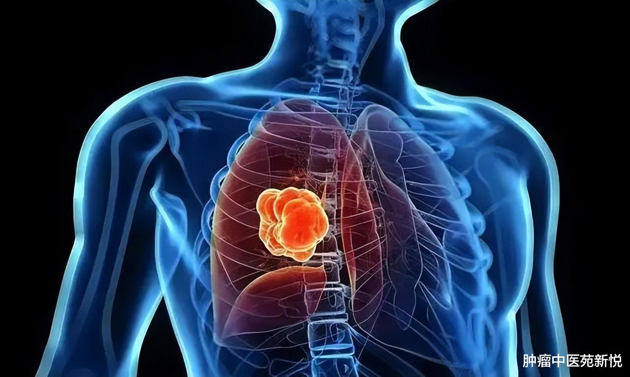 骨质增生|肺结节患者必须牢记的5句顺口溜,听听中医怎么说