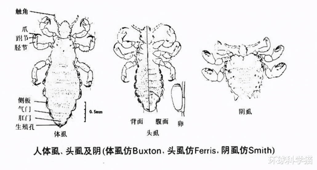 这是真的!与人类共存,活上千万年了,为何虱子现今很难见到了?