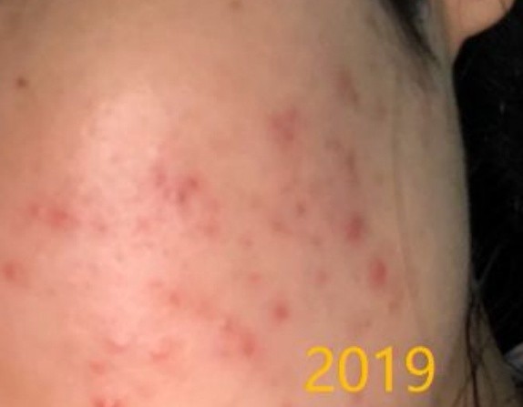 口红 建议孕妈赶紧停止这些“无效护肤”,皮肤真的会变差,还过敏烂脸