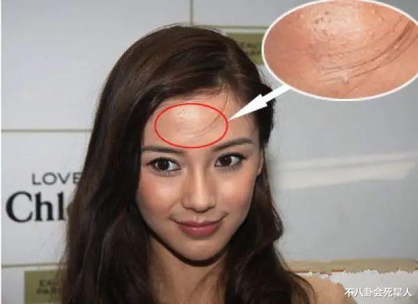 生图|精修是神颜,生图满脸痘,痘坑、黑眼圈、长斑,明星没那么美