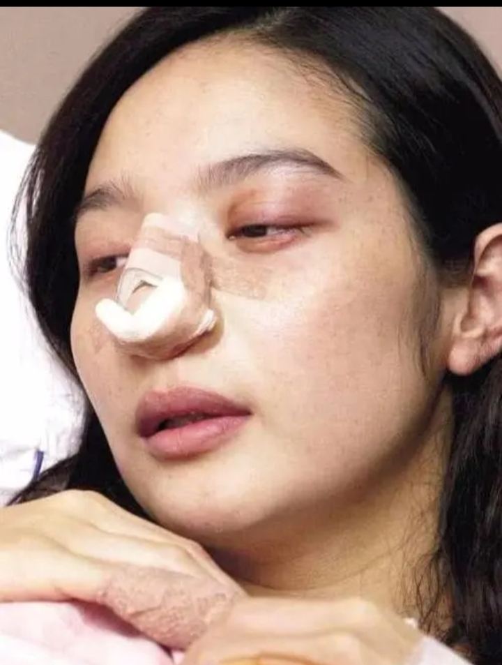 脑震荡|外在风光，内者伤心，女星私下遭老公毒打