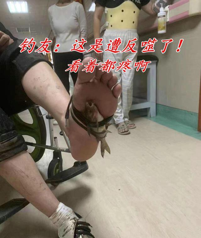 反噬?小伙钓鱼被黄骨鱼刺穿脚板,网友:我也遭遇过,瘸了一个月