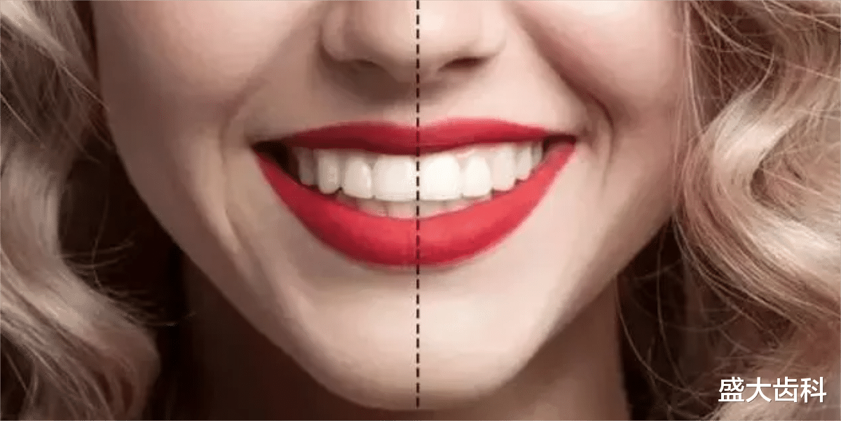 甲鱼|成人口腔正畸需要注意什么?