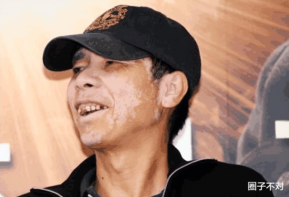 黄瑜娴|口水能过敏，天生没子宫，这6位明星的“隐疾”，有钱也治不好