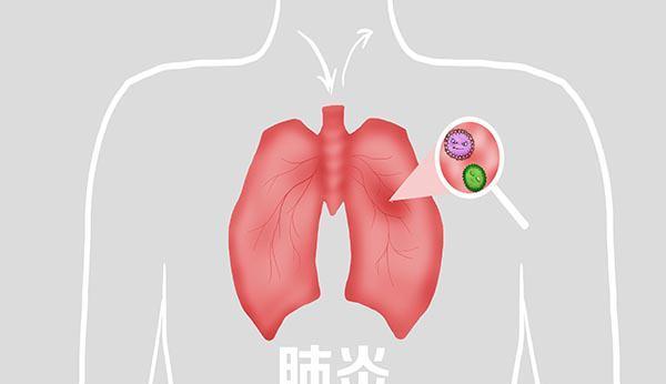 骨折|老年人骨折后，寿命大多会缩短，是啥原因？为啥老了就怕摔倒？