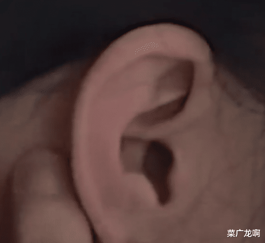案例回顾:湖南22岁聋哑女子和新婚丈夫争执时,因气不过突然开口说话