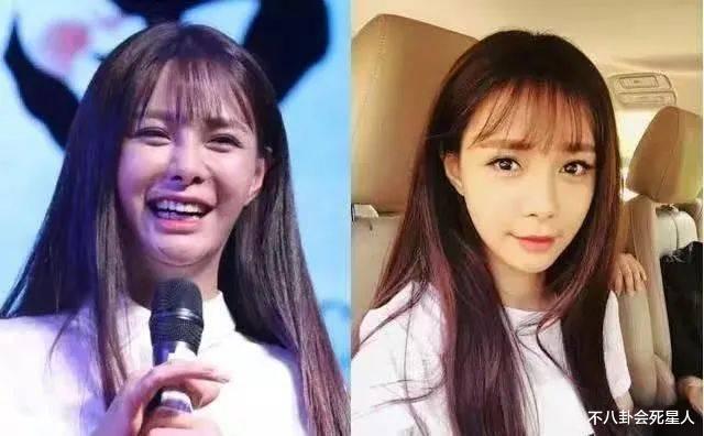 金赛纶|女星整容一直在路上：沈梦辰近照不敢认，杨子姗换个角度就变脸