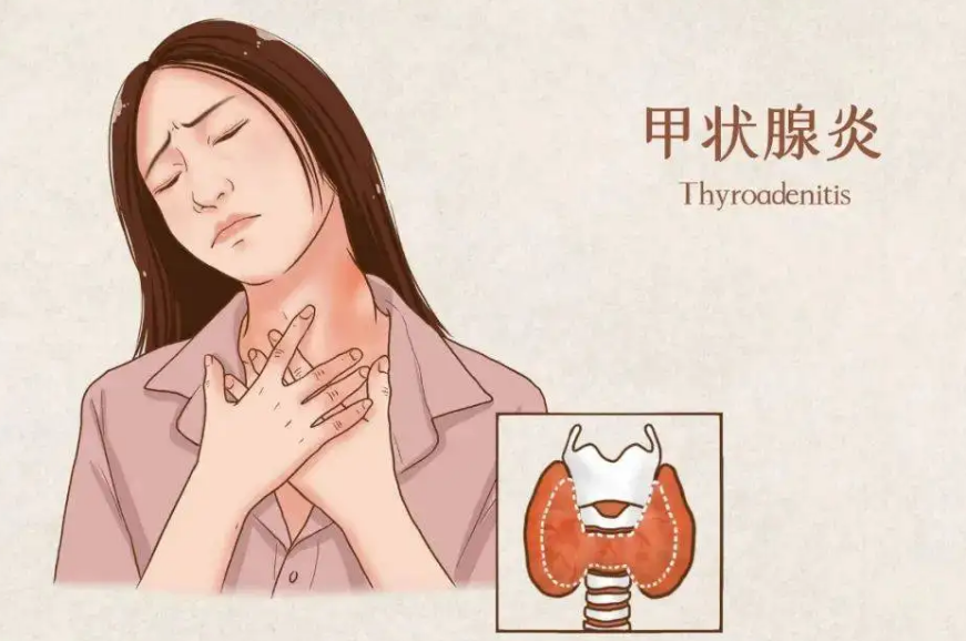 慢性腹泻|《柳叶刀》点名批评:“敷衍式”早餐,天天当成宝,甲状腺不烂才怪